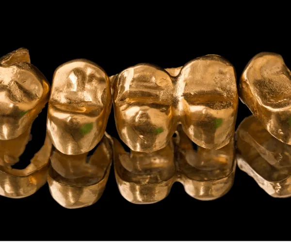 Silberbarren Salzburg